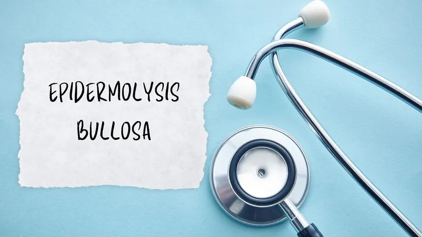 Sırbistan'da 'Kelebek Çocuklar' için Tedavi Merkezi Kuruldu Gen Terapisi Başladı