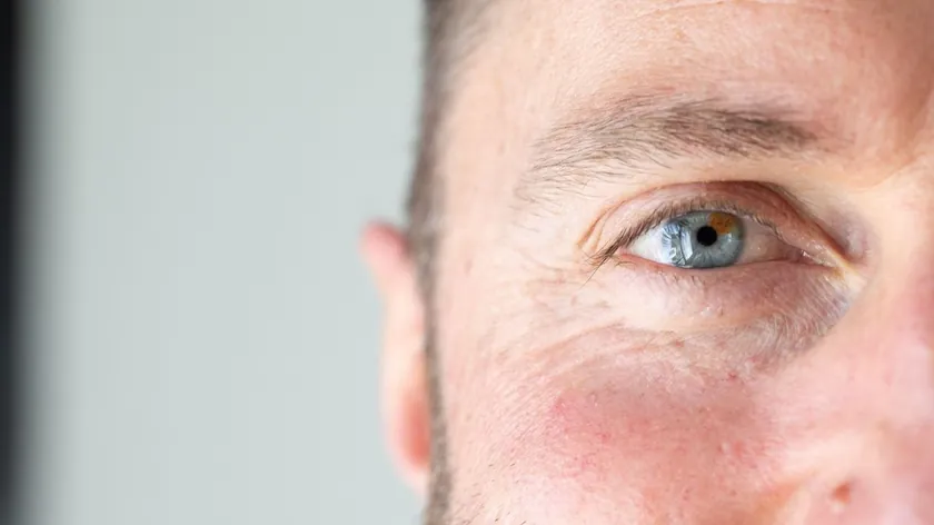 Sırp medyasında yayılan haber Stalno yüz kızarıklığı Belirtiler, nedenler ve ne zaman bir dermatoloğa gitmek gerekir