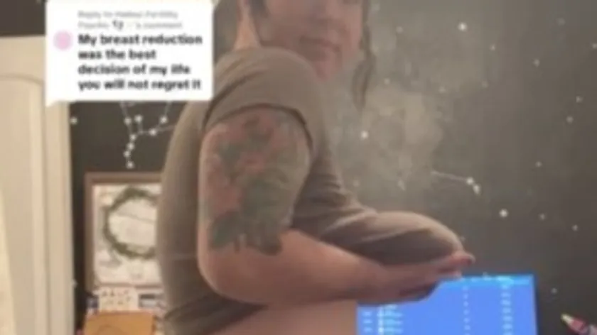 Amerikalı Kadın Büyük Göğüsleri Nedeniyle Yaşadığı Sorunlardan Kurtuldu