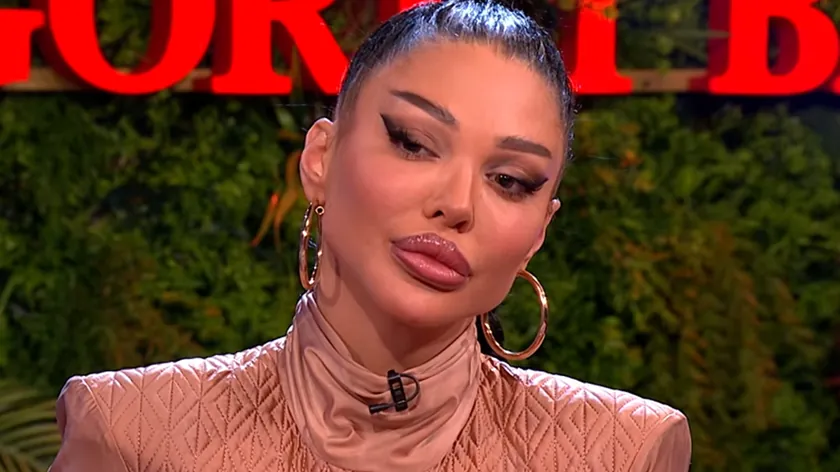 Maja Marinković'in Plastik Operasyonları Açıklandı
