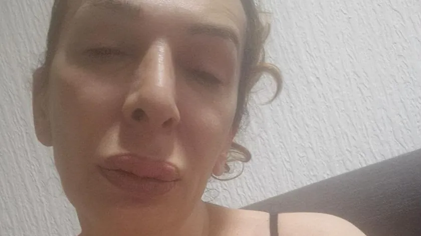 Sırp şarkıcısı Nataşa Maza yardım istediyor Evsiz kaldım, 5 gün yemek yemedim.