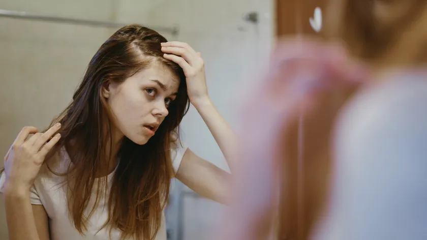 Kadınlarda Saç Dökülmesinin Temel Sebebi Hormon Dengesizliği Olarak Belirtildi