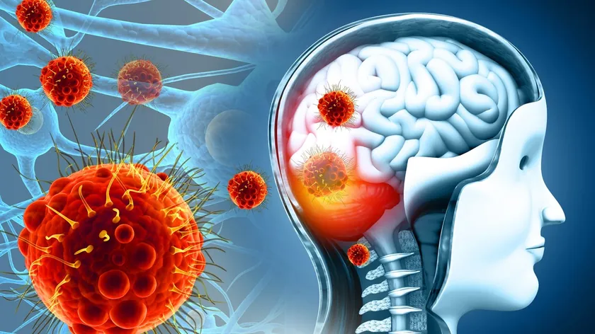 Meningit Ciddi Bir Durumdur: Belirtileri, Nedenleri ve Korunma Yöntemleri Açıklandı