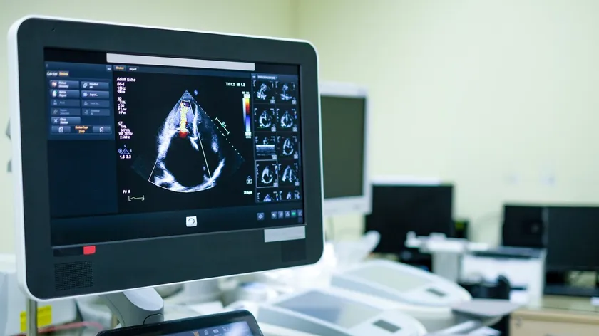 Klinika za kardiohirurgiju Kliničkog centra Srbije, 80. yıl dönümünü kutlamak için erken teşhis ve tedavi için bir tarama programı düzenliyor.