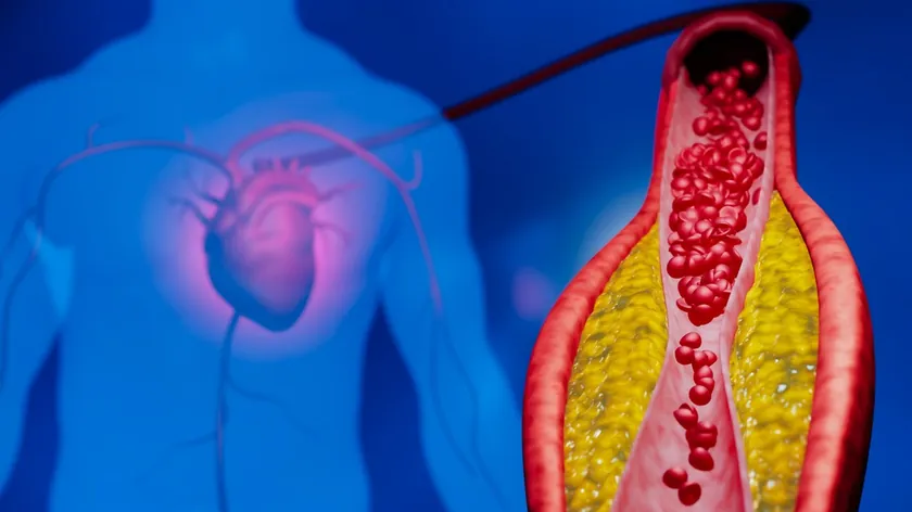 Yemek Sonrası Kan Yağları: Kolesterol ve Trigliserit Seviyeleri Nasıl Değişiyor?