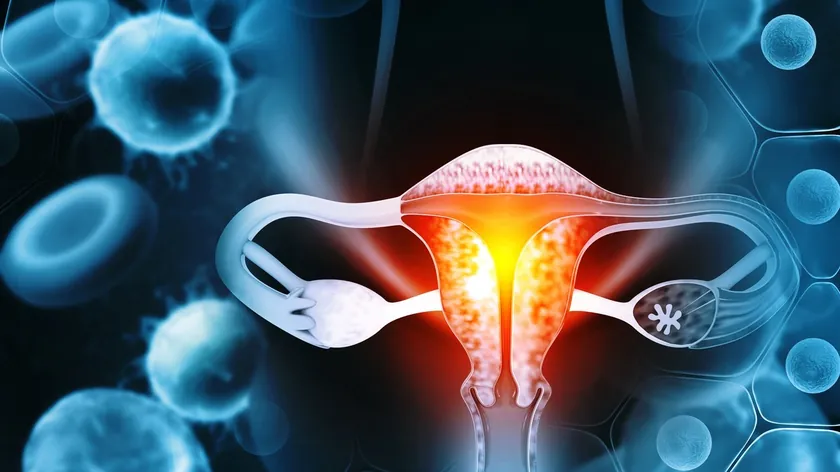 Sırbistan'da HRD pozitif yumurtalık kanseri hastaları için modern tedaviye erişim hayati önem taşıyor.