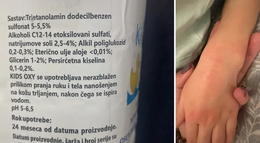 Belgrad Kreşlerinde Çocuklara Zarar Veren Sabun Kullanımı Endişe Yarattı