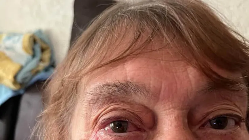 Sırbistan'ın Niş Kentinde 80 Yaşındaki Stanimirka Ristiç'ten Haber Alınamıyor