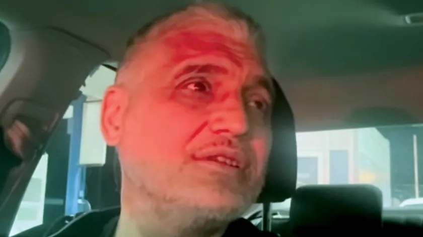 Sırbistan'da Çedomir Jovanoviç Aca Kos'a şarkı okuyarak "Yaşamaya değer" kaydetti