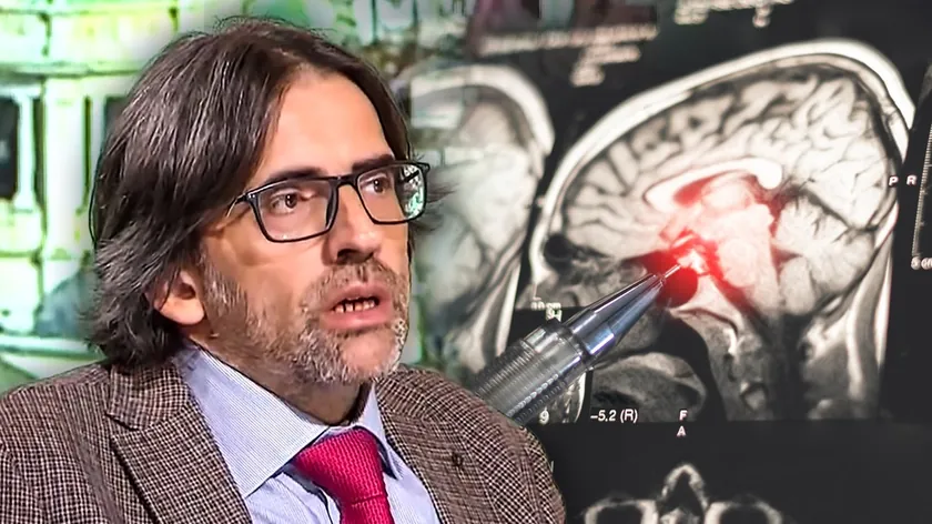 Sırbistan'da epilepside stereo-EEG yöntemi: Nöbet odağı doğrudan beyinden tespit ediliyor