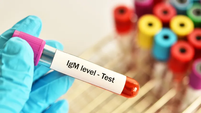 IgM antikorları enfeksiyonla savaşta ilk işaret belirtileri ve nedenleri açıklandı