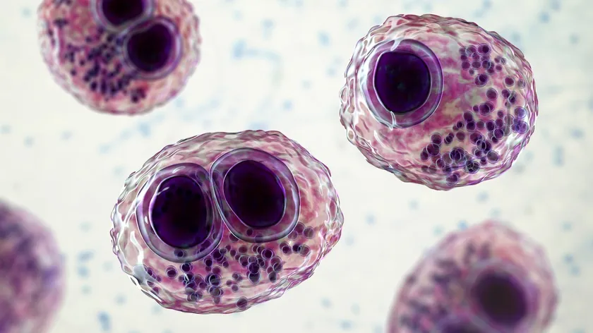 Citomegalovirüs (CMV) enfeksiyonu nasıl ortaya çıkarılır?