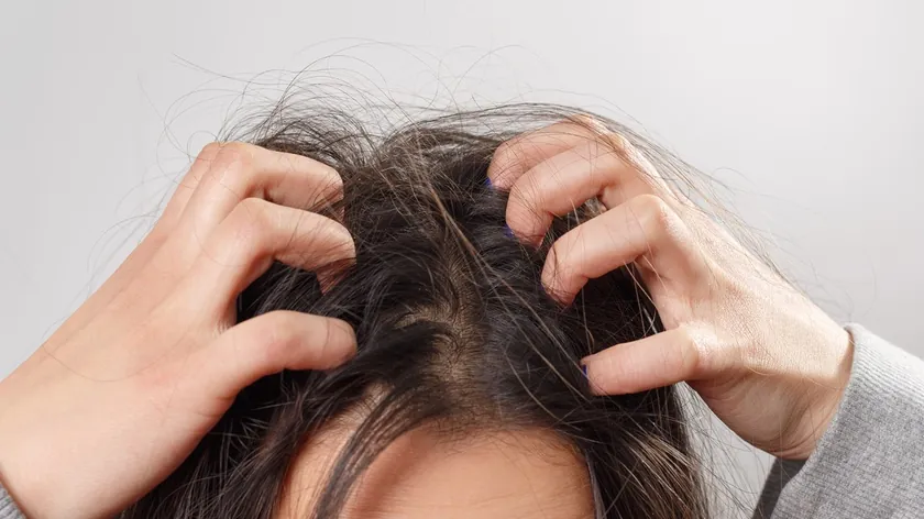 Kafadaki kabuklanmaların nedenleri ve tedavi yöntemleri uzmanlar tarafından detaylıca aktarıldı