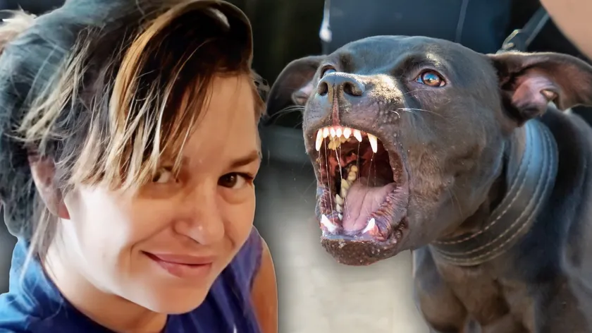 Kanzas'ta bir pitbull, hamile bir kadını saldırıya uğrattı Çocuk (6) onu serbest bıraktı, hayvan kanlıca saldırıya geçti (foto)