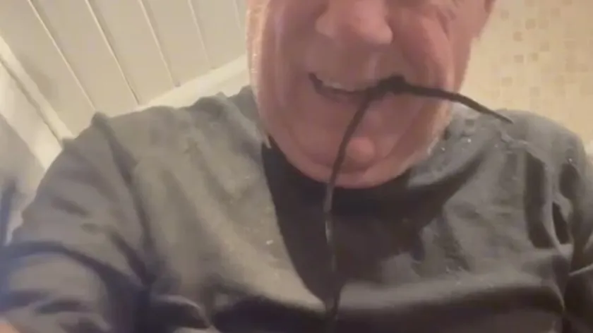 Britanya'da diş hekimi randevu krizi nedeniyle kendi dişini çeken adam