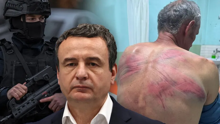 Sırbistanlı bir adam Kosov'da polis tarafından işkenceye maruz bırakıldı.