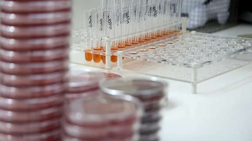 Dışkıda Mukus: Ne Zaman Doktora Başvurulmalı ve Olası Nedenleri Nelerdir