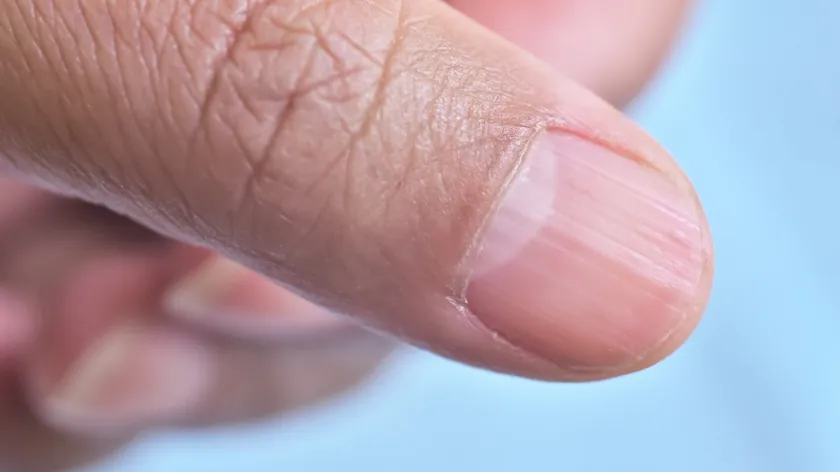 Sırbistan Uzmanları Tırnaklardaki Yarım Ayın Sağlık Sırlarını Açıkladı