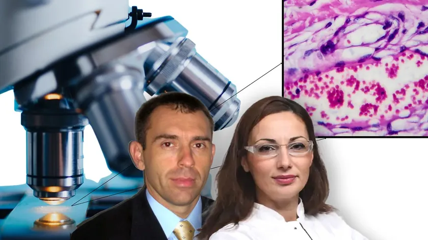 Sırbistan'da Hodgkin Lenfoma Tedavisinde Modern Biyolojik Terapi Hastalara Geç Ulaşıyor