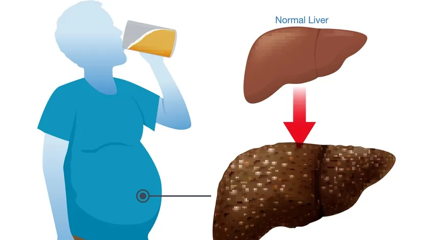 Sırbistan: Araştırma, kısa sürede yoğun alkol tüketiminin karaciğere daha çok zarar verdiğini bildirdi.