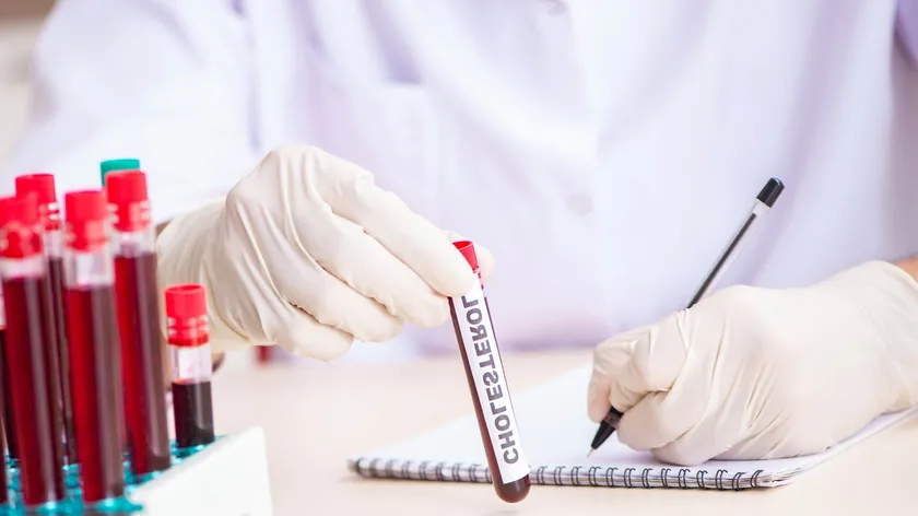 Güncel Kolesterol Yönergeleri Erken Tarama ve Düşük LDL Hedefleri Vurguladı