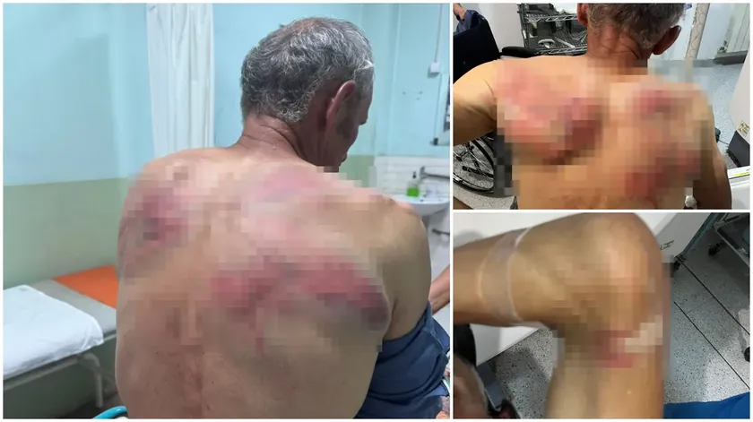 Kosova Polisi Nenad Rašković'i Saldırıp Yaraladığı Iddiası