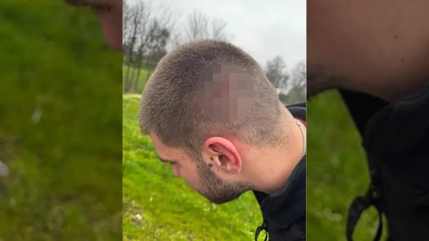 Sırbistan'da Aktivist Đoković'e Saldırı Hırvatistan Vatandaşı Failler Arasında