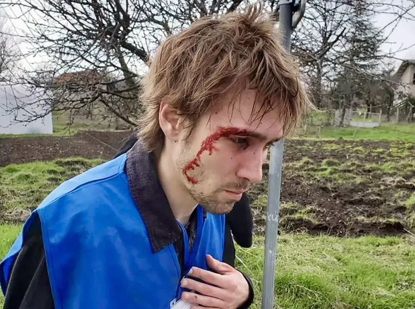 Sırbistan'da yerel seçimler sırasında Bor'da öğrenciye korkunç dayak atıldı