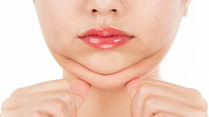 Yüzdeki Yağları Azaltmak İçin Egzersiz, Diyet ve Yaşam Tarzı Değişiklikleri Önemli Belirtildi