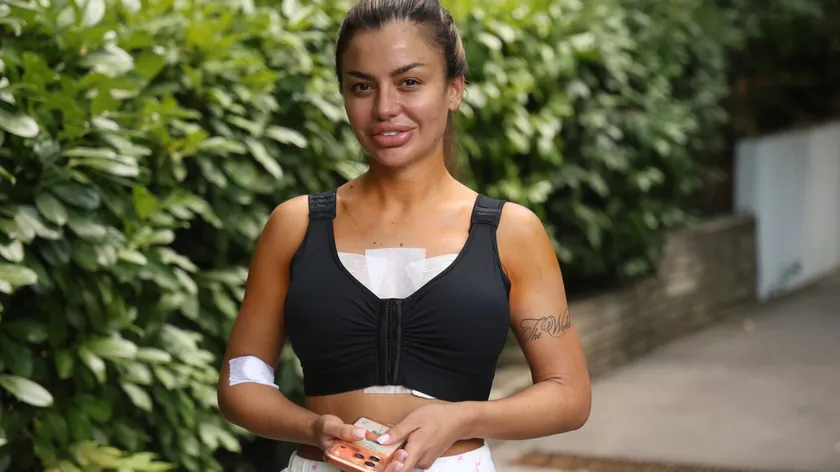 Sanja Grujić estetik operasyonundan sonra medyaya açıklamalar yaptı.