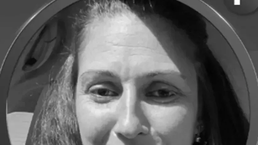 Sırbistan Leskovac'tan Emilija Despotović Rahim Ağzı Kanseriyle Uzun Mücadelenin Ardından Hayatını Kaybetti