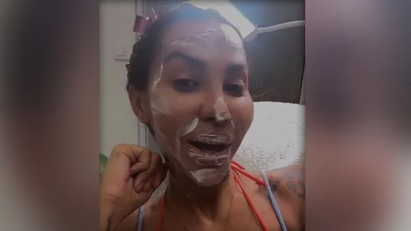 Aneli Ahmić, "Elita" yarışmasından sonra estetik operasyonlara gitti.