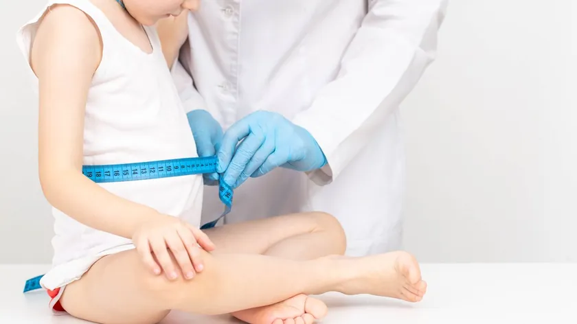 Kwashiorkor: Çocuklarda protein eksikliğinin yol açtığı tehlikeli beslenme bozukluğu belirtileri