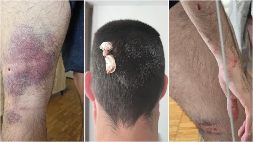 Belgrad'da siyasi sloganlar yazan grup genç bir adamı darp etti