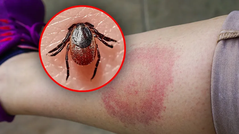 Sırbistan'da Sıcak Hava Uyarısı: Kene ve Böcek Riskine Karşı Uzman Tavsiyesi