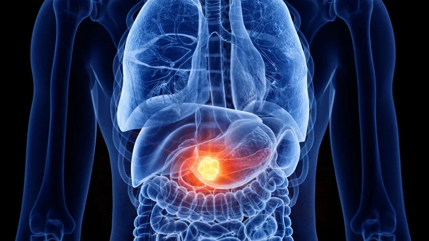 Sırbistan Karaciğer Kanseri Tedavisinde Dünyanın Önde Gelen Uzmanından Övgü Aldı