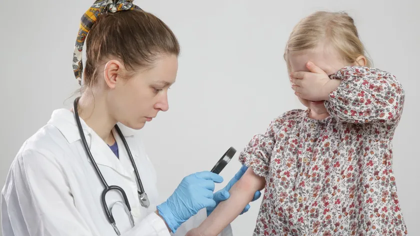 Sırbistan'da Atopik Dermatitise Dikkat: 22 Nisan Ulusal Gün İlan Edildi ve Uzmanlar Toplanıyor