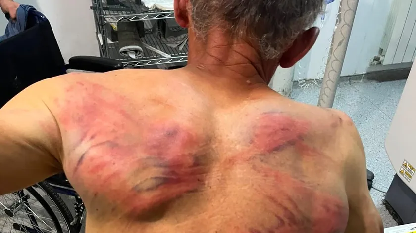 Sırbistanlı bir vatandaşın Kosova'da brutalca dövülmesi üzerine Beograd'a sevk edildi.