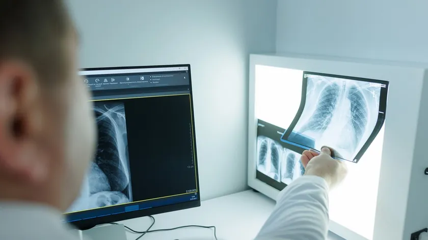 Sırbistan Akciğer Kanseri Teşhisi Hızlandı Tedavi Onayı Süresi Uzun Bekletiyor